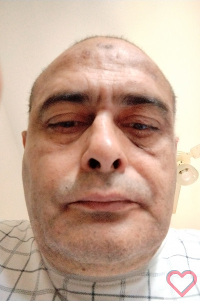 Patacchione