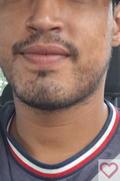 Pedrolukaa
